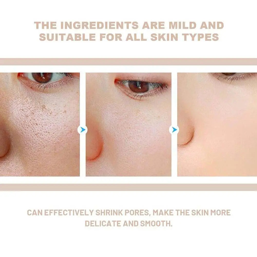 Magic Rice Peel Serum – Blackhead Eraser & Hydrator