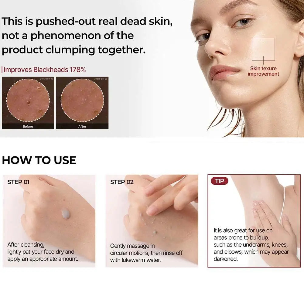 Magic Rice Peel Serum – Blackhead Eraser & Hydrator