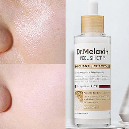 Magic Rice Peel Serum – Blackhead Eraser & Hydrator