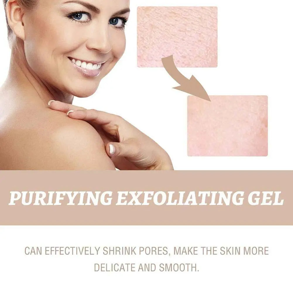 Magic Rice Peel Serum – Blackhead Eraser & Hydrator